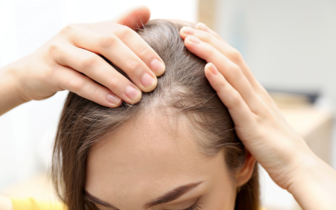 The Many Causes of Hair Loss